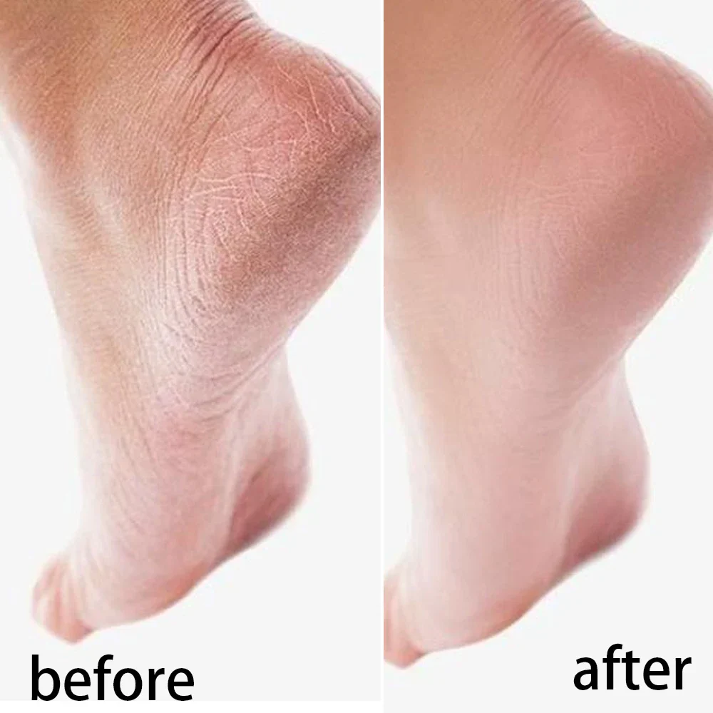 Moisturizing Reusable Hydrating Socks - Image 6
